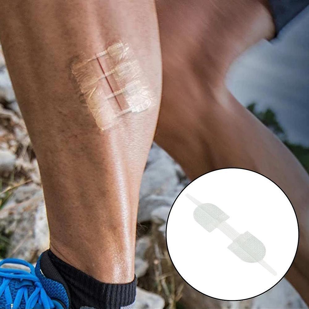 Everlit Wound Closure Kit – 2 Pcs, Suture-Free Strips