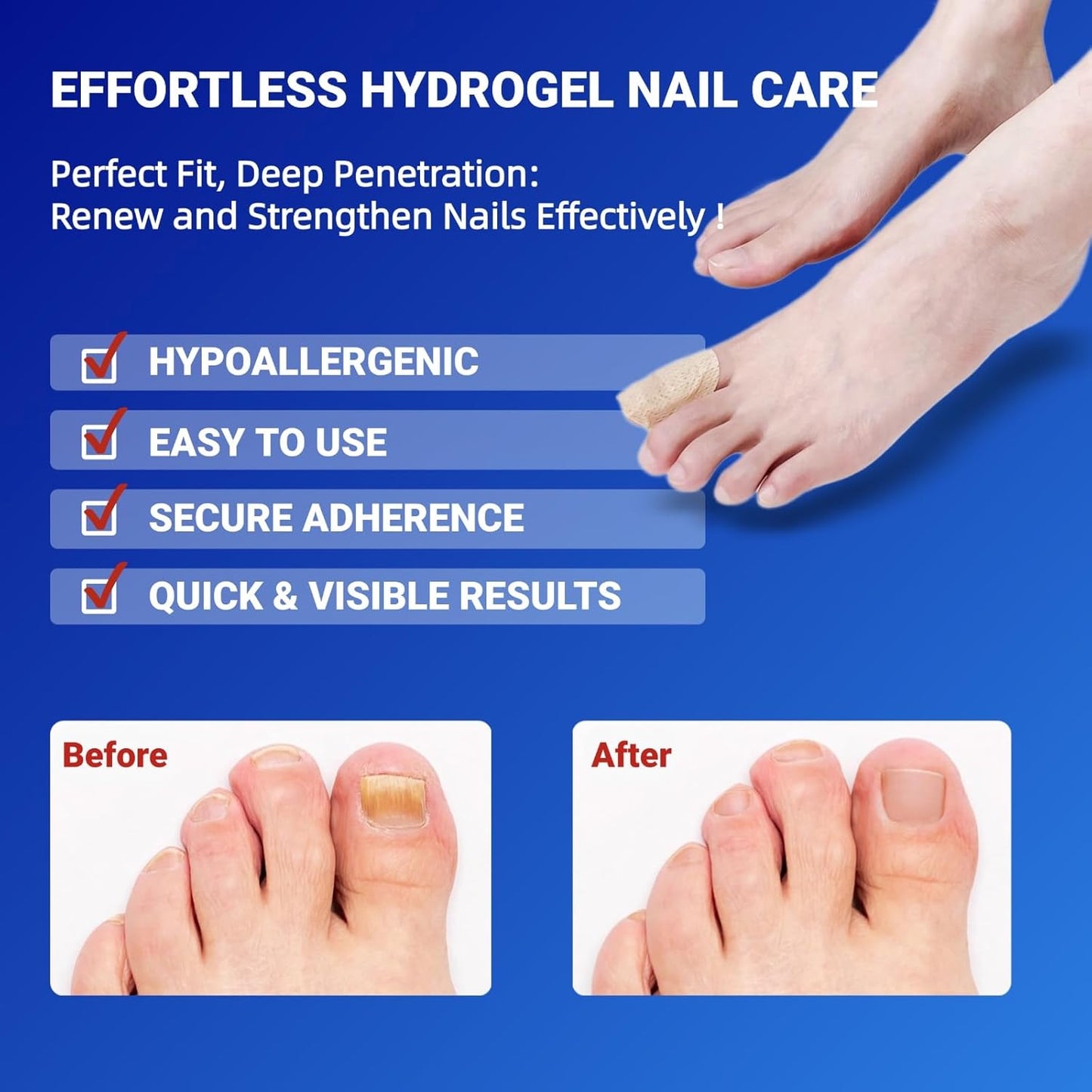 Fungal Nail Patches